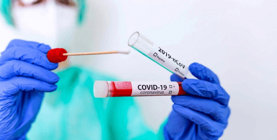 Coronavirus Opportunita Investimento